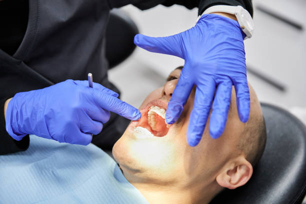 Best Emergency Wisdom Tooth Extraction in Sparta, TN